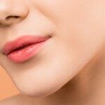 chin augmentation