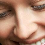 rhinoplasty