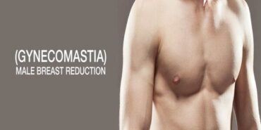 gynecomastia surgery india