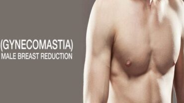 gynecomastia surgery india