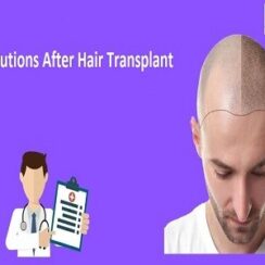 Post Operative Care and Precautions After Hair Transplant