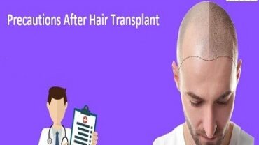 Care After Hair Transplant Surgery