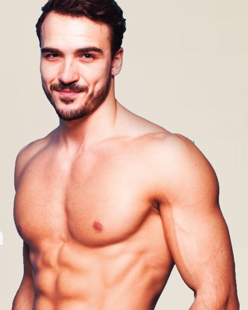 gynecomastia