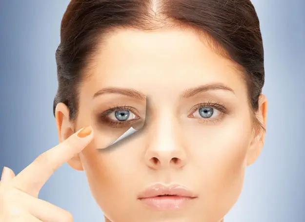 under eye dark circles treatment in gurgaon