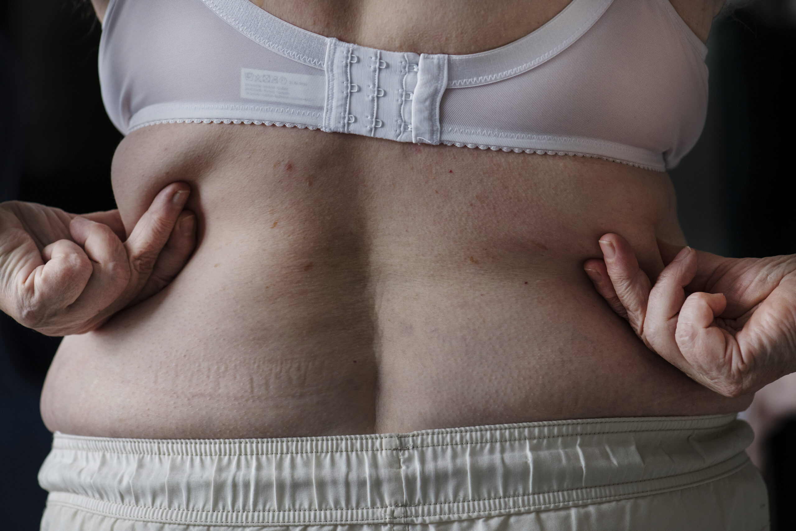 closeup-of-obese-elderly-woman-2023-11-27-05-22-27-utc-scaled.jpg