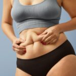 Lipo 360 before and after