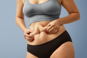 liposuction fat removal surgery