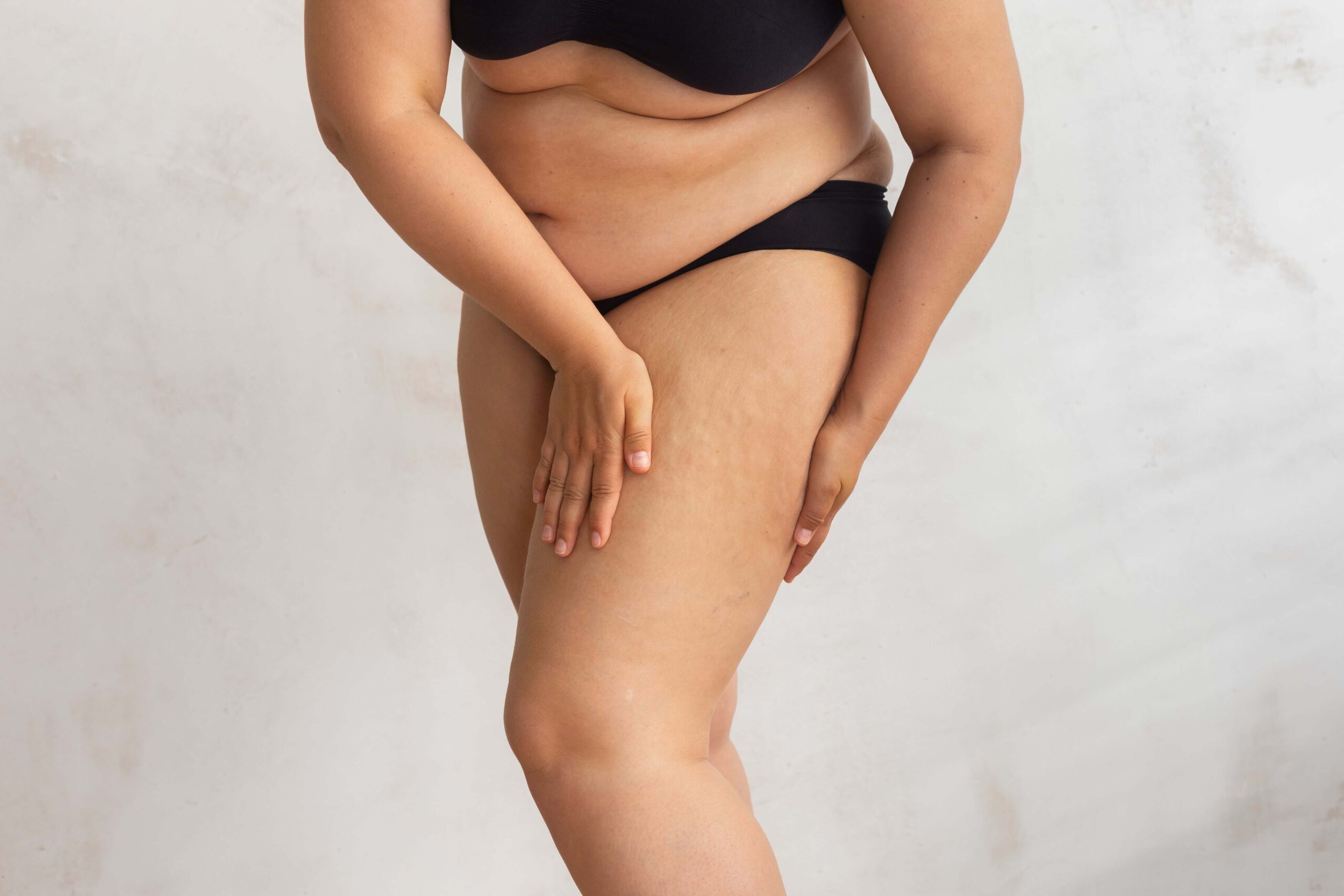 Liposuction Results : Before and After – How Long to See Results
