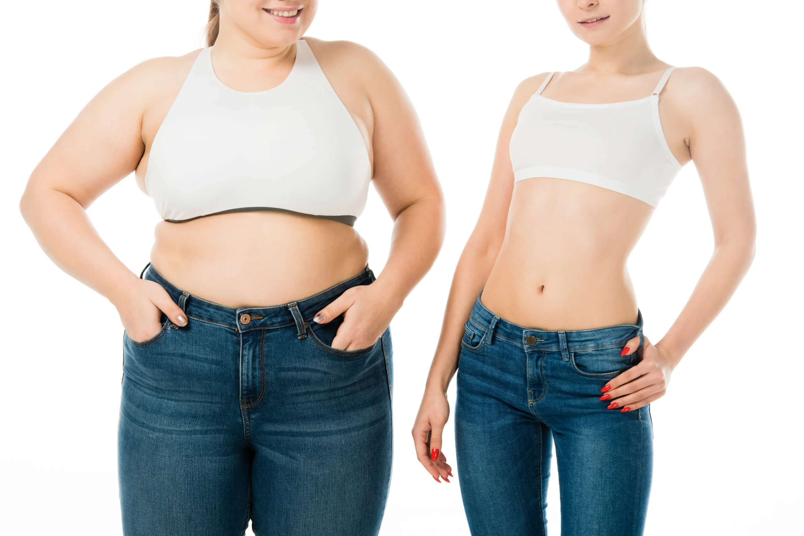 I Cured My Lipedema Naturally: Before and After Weight Loss + Treatment That