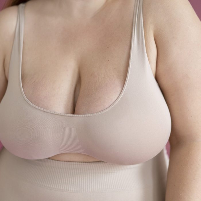 Best-Option-for-Saggy-and-Loose-Breast-scaled