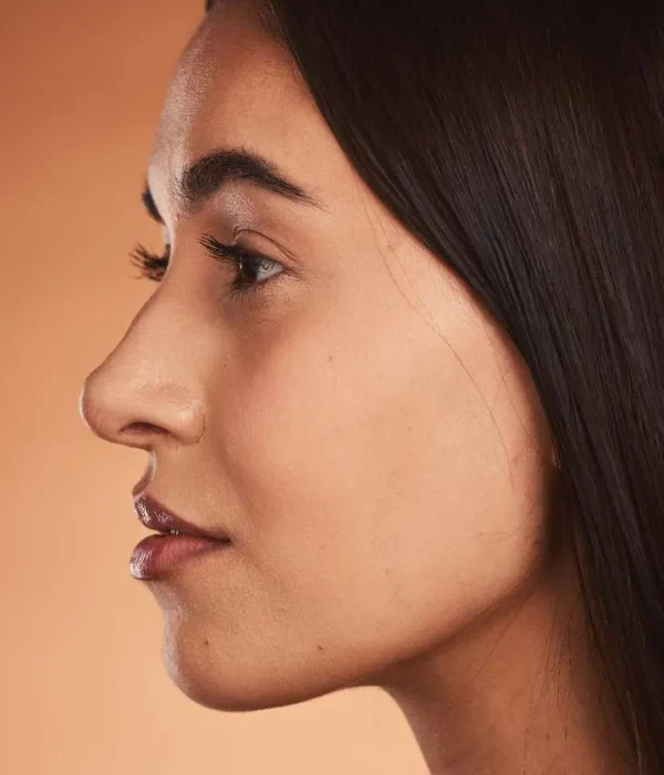 Rhinoplasty Gurgaon before and after